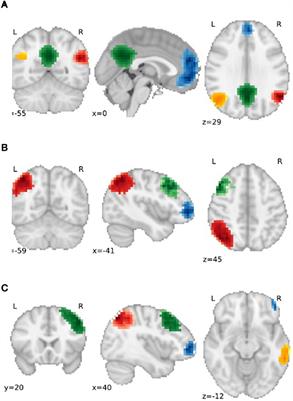 Altered Functional Connectivity and Cognition Persists 4 Years After a Transient Ischemic Attack or Minor Stroke